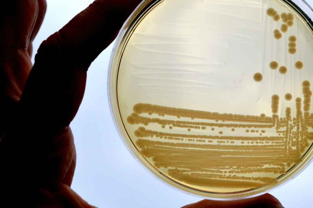 escherichia coli nei richiami alimentari