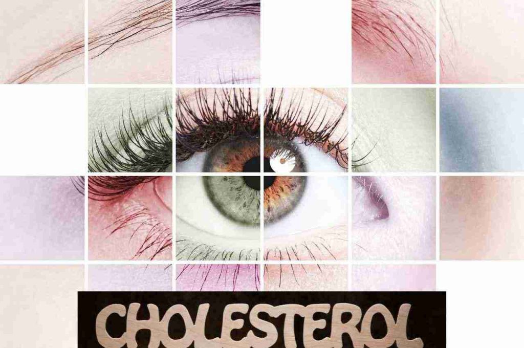 riconoscere i segnali colesterolo